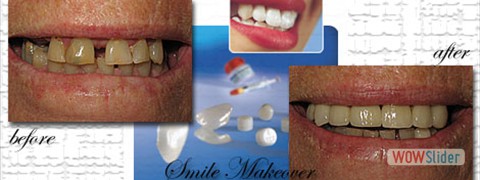 smile_makeover08