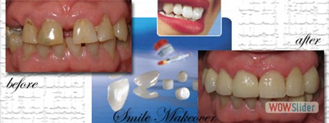 smile_makeover09